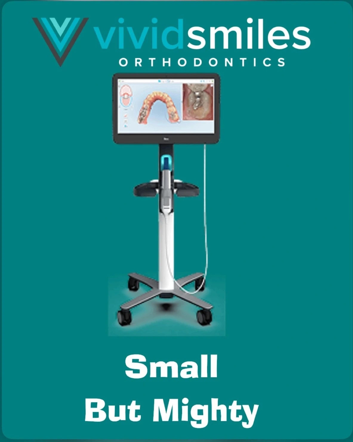 iTero digital scanner used for removable clear aligner impressions